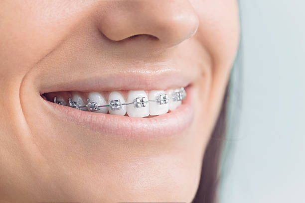 Best Veneers and Lumineers  in Abilene, TX